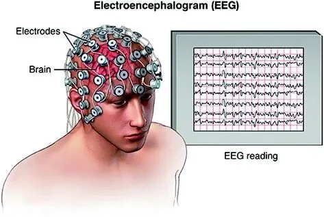 示意图:戴满电极帽的头部与一块显示 EEG 波形的屏幕