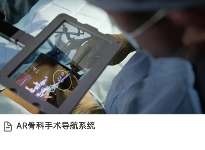 Notion 案例卡片封面：手术台上方的显示屏叠加了脊柱三维模型，标题 AR 骨科手术导航系统
